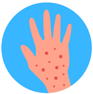 Icône représentant une main avec des éruptions cutanées sous forme de petits points rouges, indiquant une irritation ou une infection de punaise de lit.
