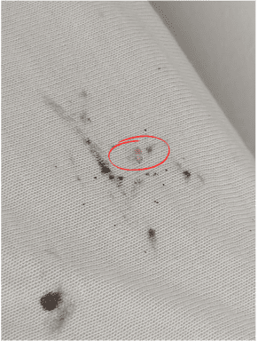 Tissu d'un matelas taché de déjections et d'une mue de punaise de lit encerclée en rouge.