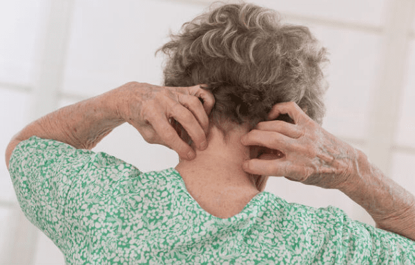 Punaises de lit en EHPAD.