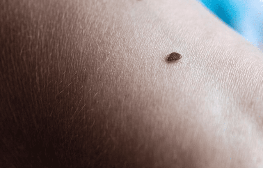 Punaise de lit marchant sur la peau humaine, en train de chercher une zone à piquer